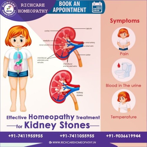 Kideny-stone-homeopathy-treatment-in-bangalore.jpg