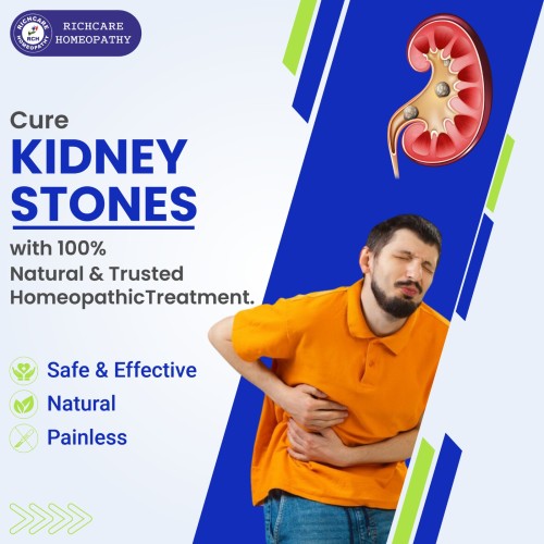 Kidney-Stone-01.jpg
