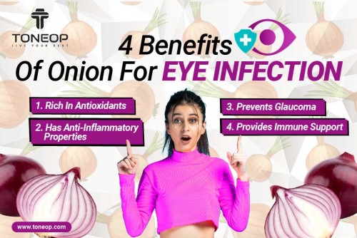 4-Benefits-Of-Onion-For-Eye-Infection.jpg