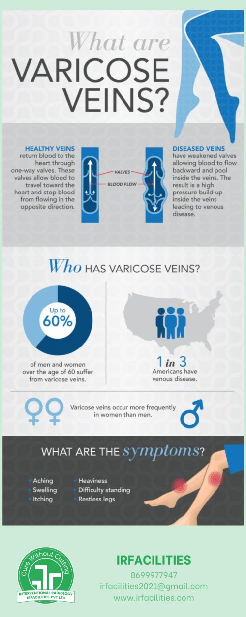 Top-Rated-Varicose-Veins-Specialist-in-Mohali---IRFACILITIES.jpg