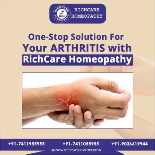 Arthiris-treatment.jpg