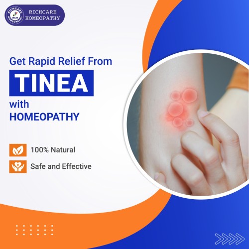 tinea-treatment-01.jpg