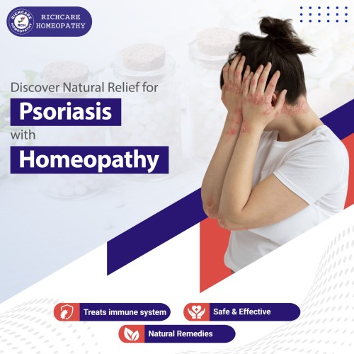 Psoriasis-Treatments-01.jpg