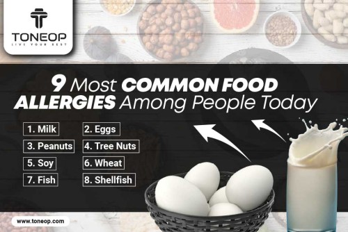 9-Most-Common-Food-Allergies-Among-People-Today.jpg