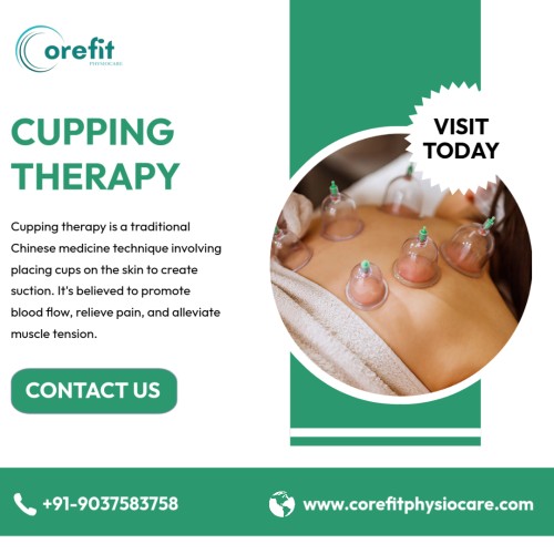 Cupping-Therapy---Corefit-Physiocare.jpg