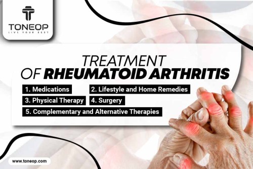 Treatment-of-Rheumatoid-Arthritis.jpg