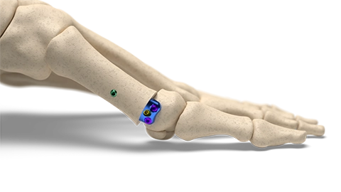 minilock_gbs_home-2.png