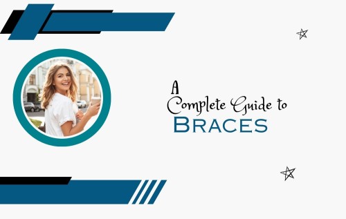 A-Complete-Guide-to-Braces1500x952.jpg