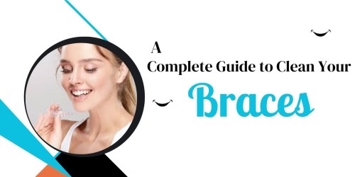 A-Complete-Guide-to-Clean-Your-Braces.jpg