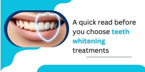 A-quick-read-before-you-choose-teeth-whitening-treatments.jpg