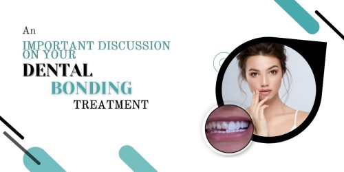 An-important-discussion-on-your-dental-bonding-treatment.jpg