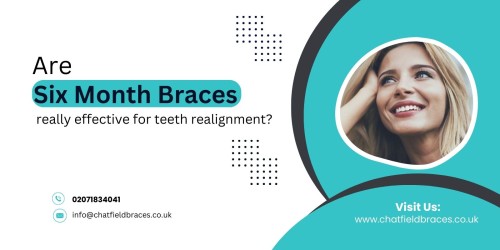 Are-Six-Month-Braces-really-effective-for-teeth-realignment.jpg