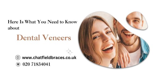 Here-Is-What-You-Need-to-Know-about-Dental-Veneers.jpg