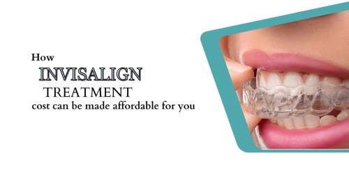 How-Invisalign-treatment-cost-can-be-made-affordable-for-you.jpg