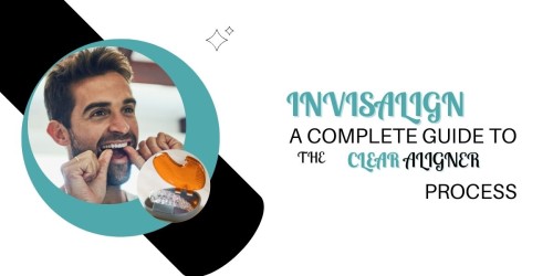 Invisalign-A-Complete-Guide-to-the-Clear-Aligner-Process.jpg