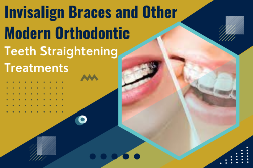 Invisalign-Braces-and-Other-Modern-Orthodontic-Teeth-Straightening-Treatments.png