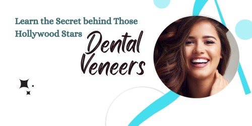 Learn-the-Secret-behind-Those-Hollywood-Stars_-Dental-Veneers.jpg