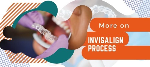 more-on-invisalign-process.jpg