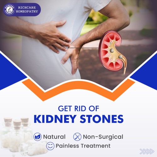 kidney-stone-treatment-01.jpg