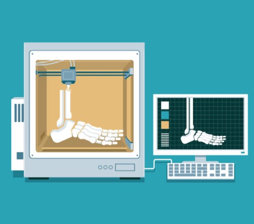 Autograft-vs.-Allograft-vs.-Synthetic-Bone-Graft-Materials.jpg