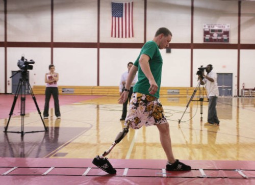 Osseointegration-for-Prosthetic-Attachment-A-Game-Changer.jpg