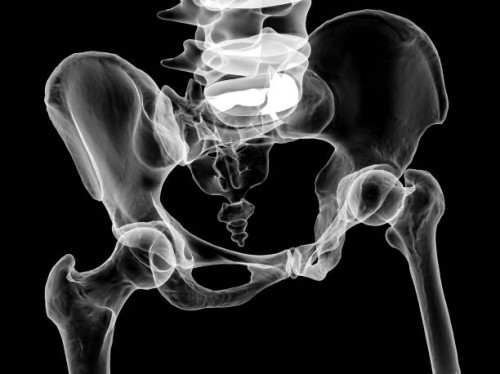 Periacetabular-Osteotomy-3.jpg