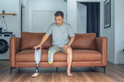Prosthetics-and-Amputation-Technology-Changing-Lives.jpg