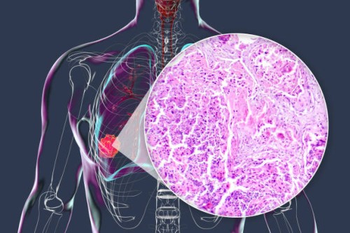 Types-of-Bone-and-Soft-Tissue-Tumors-in-Orthopedics.jpg