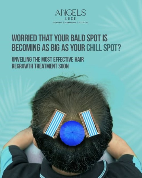 Hair-Transplantation.jpg