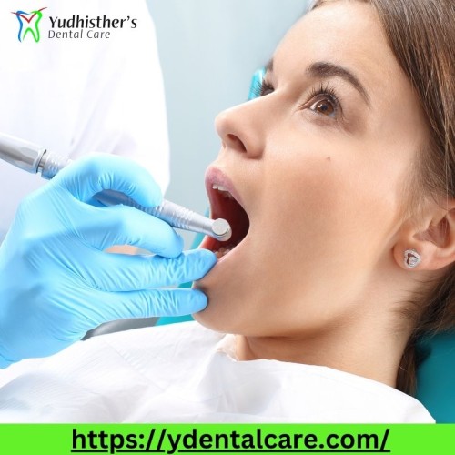 Root-canal-treatment-paschim-vihar-1.jpg