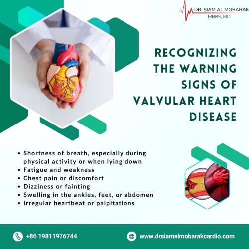 drsiam--recognizing-warning-of-vhd.jpg