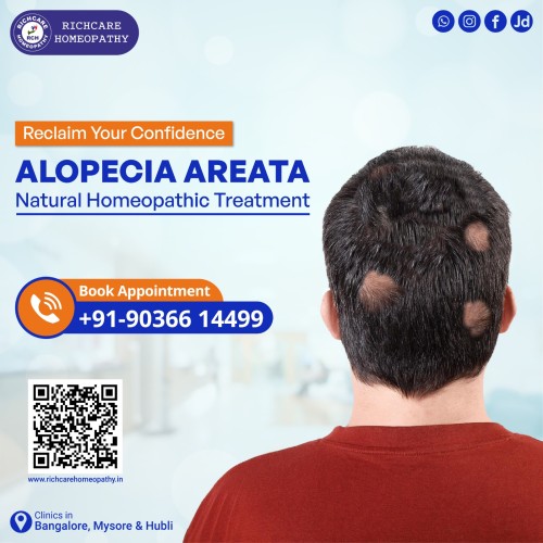 Hair-fall-treatments-in-bangalore--richcare-homeopathy.jpg