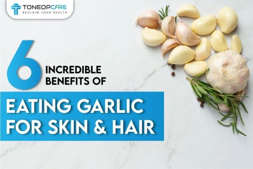 Benefits_Of_Eating_Garlic_For_Skin_e6d1dccc96.jpg