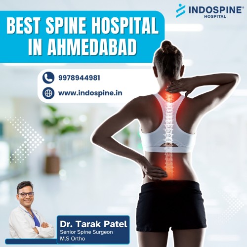 best-spine-hospital-in-ahmedabad.jpg