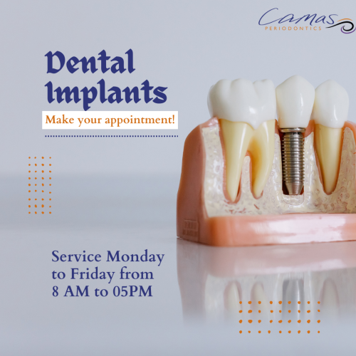 Dental-implants-placement-A-Technique-of-Modern-Dentistry.png