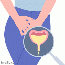 Colorectal-Cancer-treatment-in-Odisha.gif