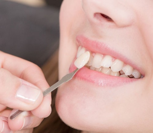 Best-Dental-Care-in-New-Hyde-Park-Gentle-Advanced-Dentistry.jpg